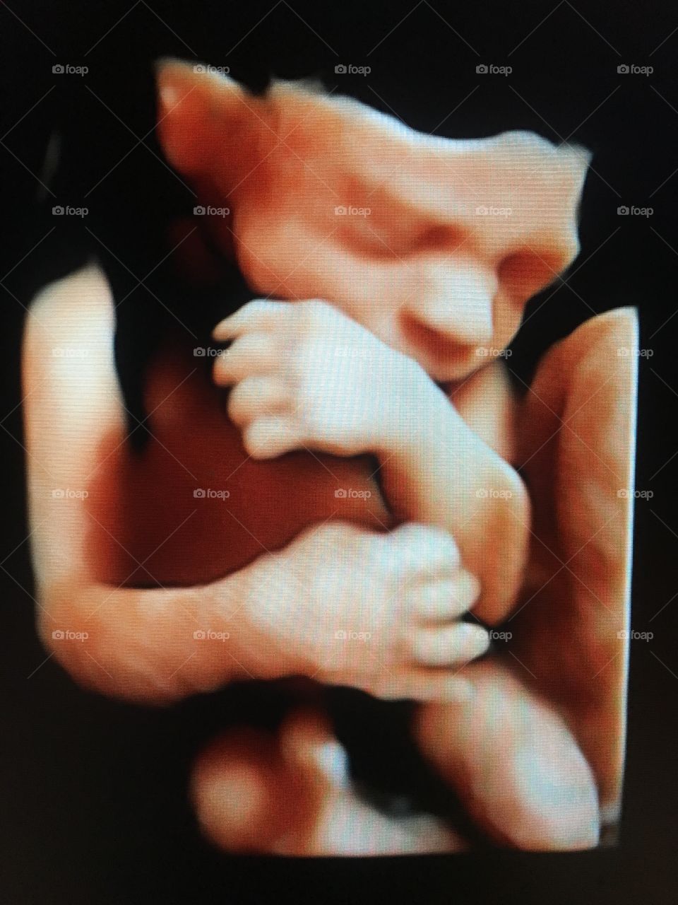 3D Ultrasound Image of a Baby
