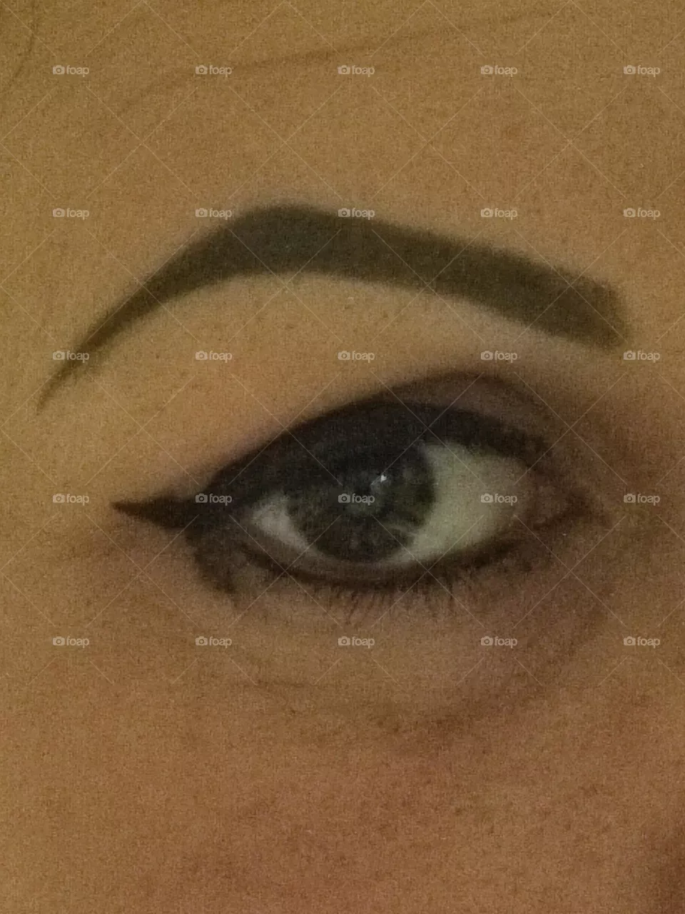 Eye
