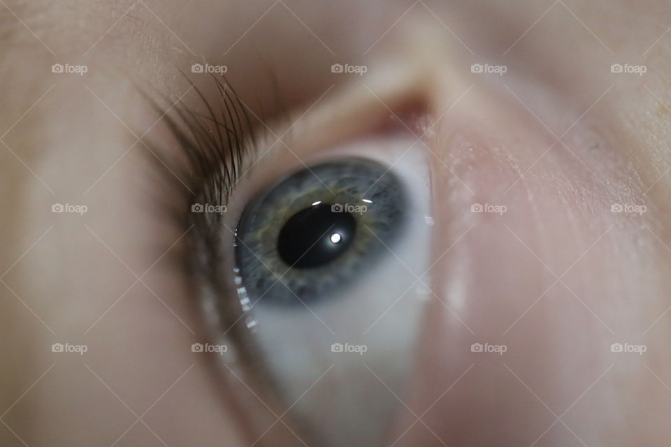 Eyeball iris