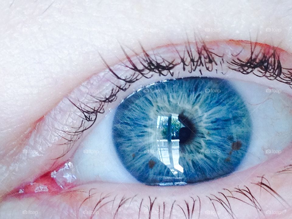 Blue eye