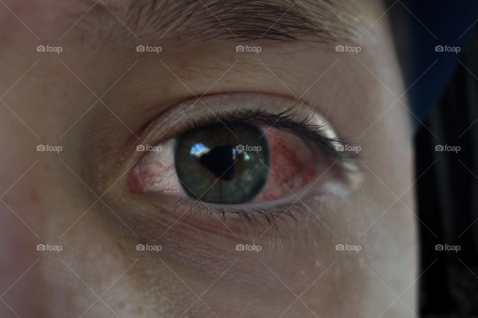 I edited Todd's eye 💉