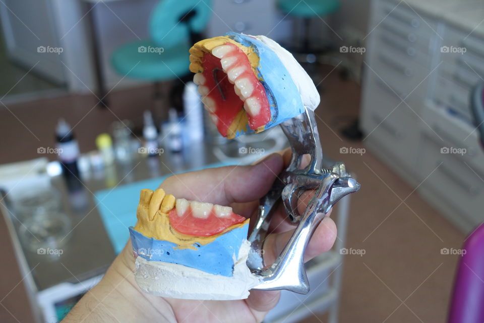 Dental composition