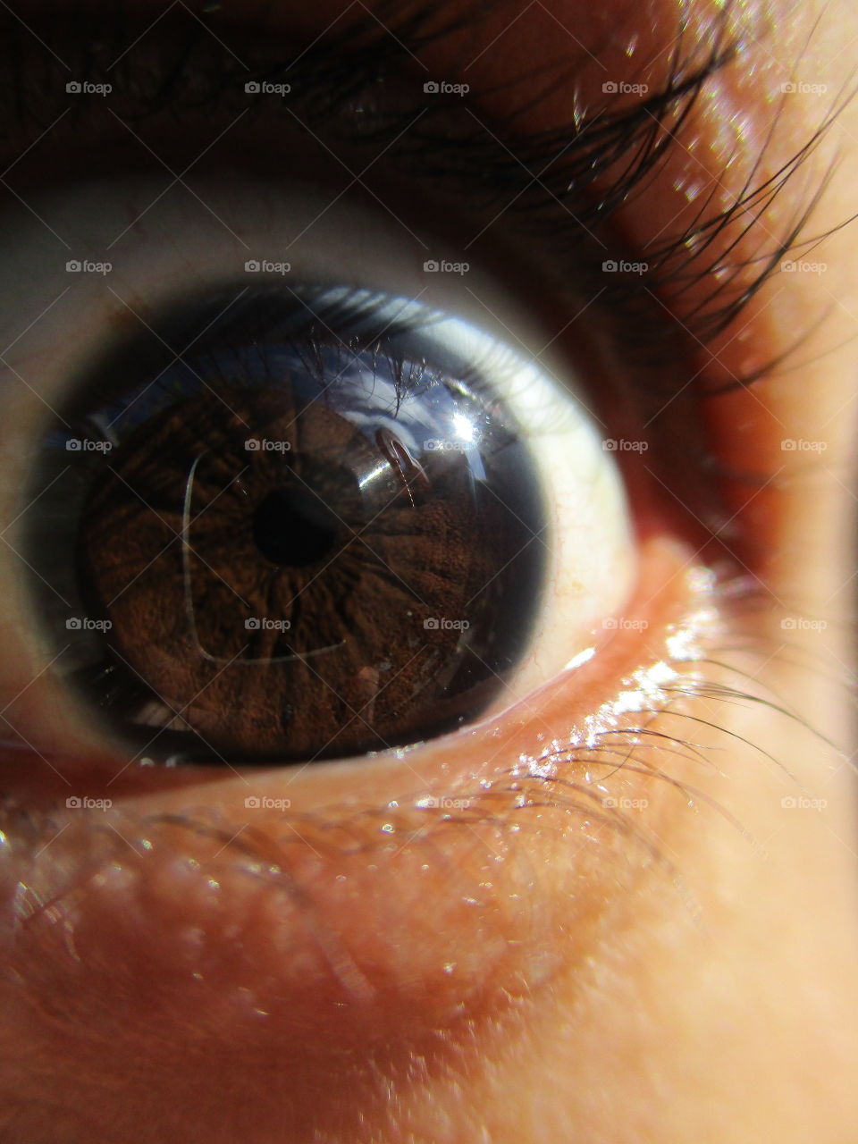 iris eye