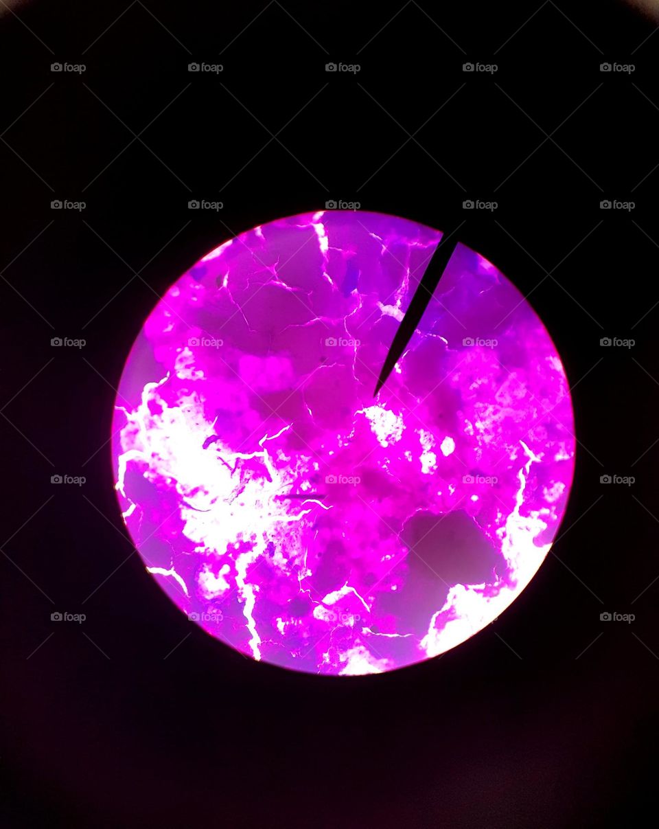 tuberculosis on a mictoscope