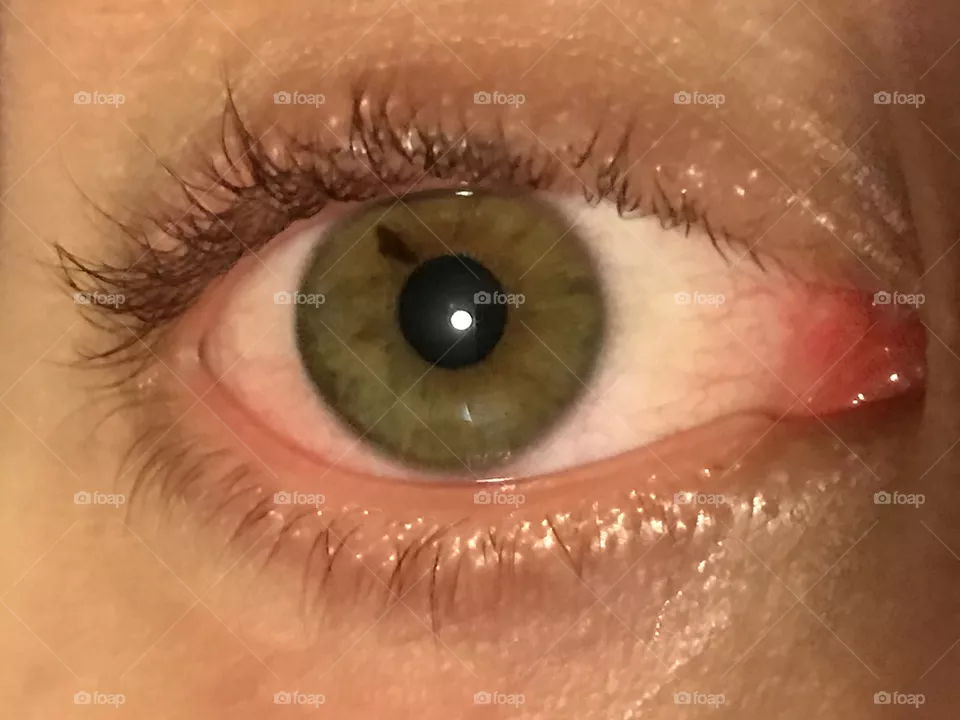 Eye