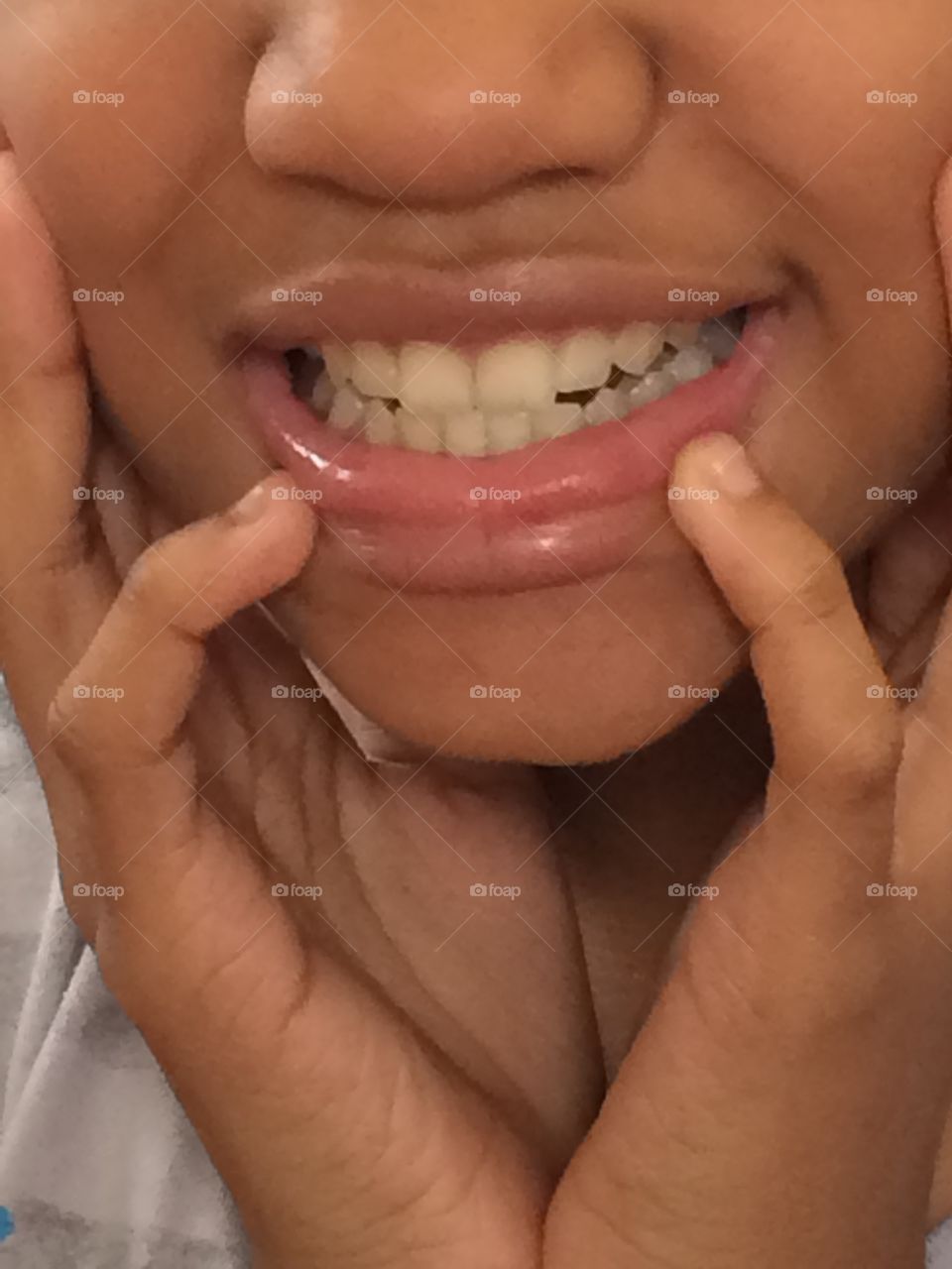 Keep your teeth clean and bright 