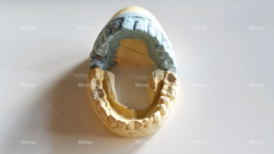 Dental molding impressions