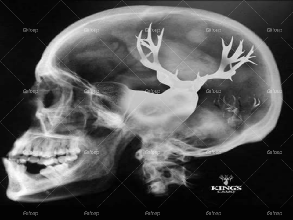 human scull with deer in brain