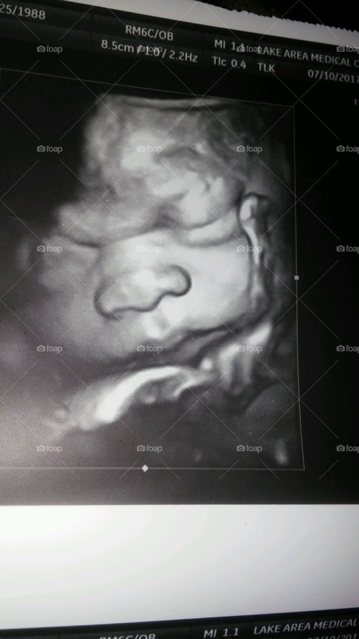 Baby profile in womb