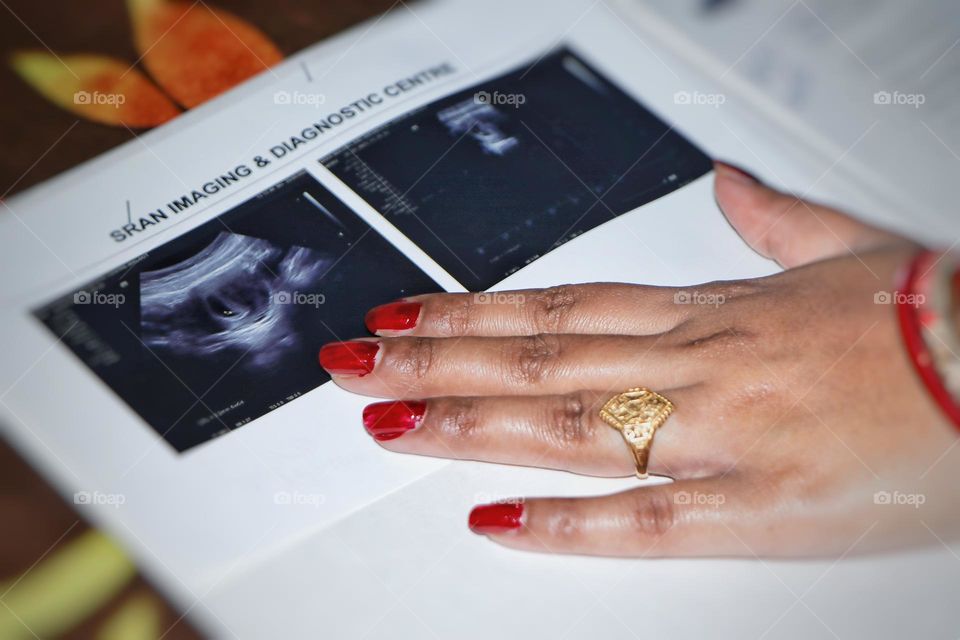 my baby first image (6weeks)