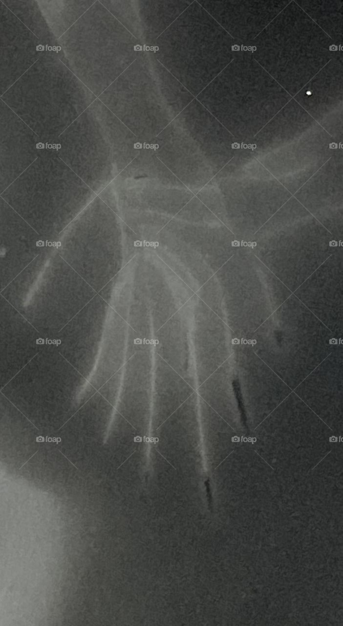 An eerie image of what appears to be an x-ray of a non-human hand. In reality, it’s just static attracting dust on a surface in curious and unique designs.