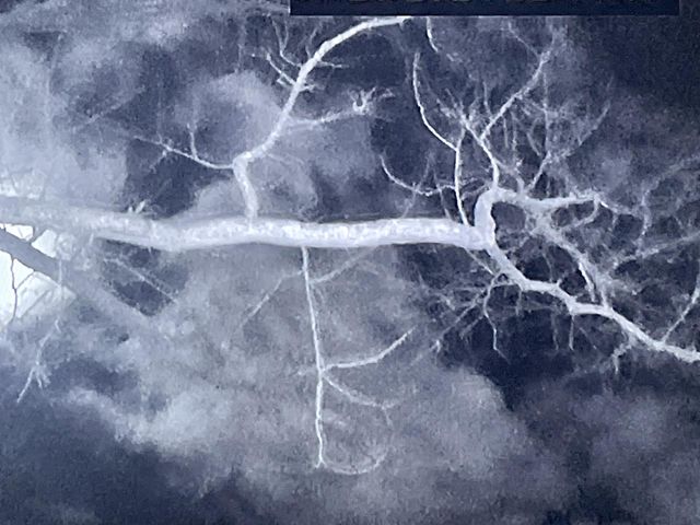 Tree limb 