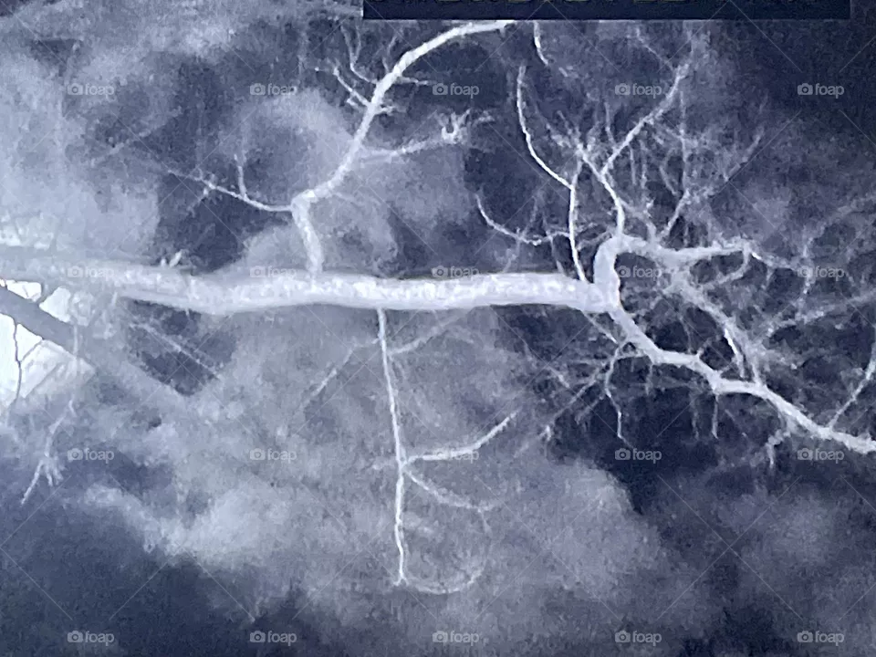 Tree limb 