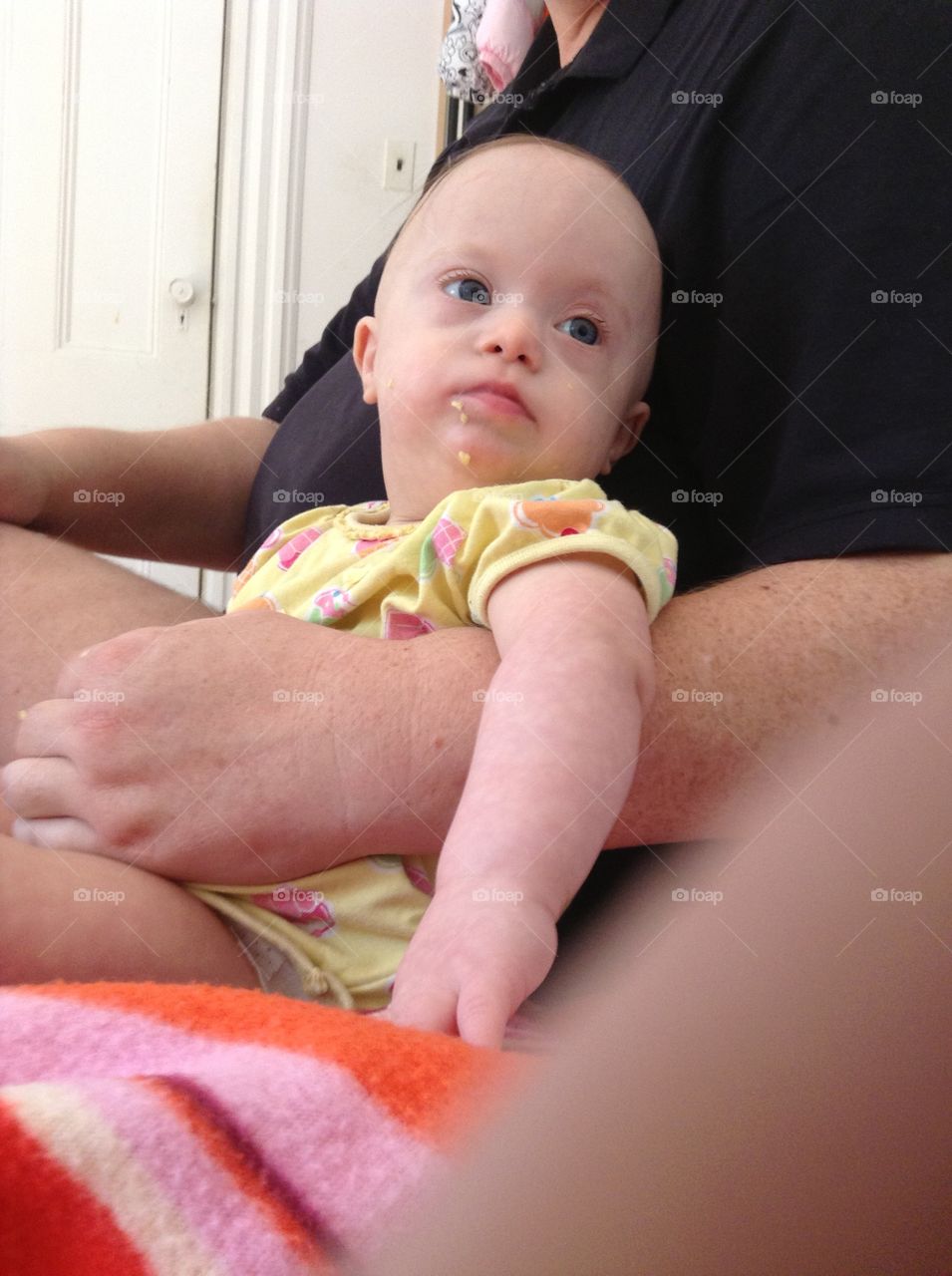 Baby with Down syndrome