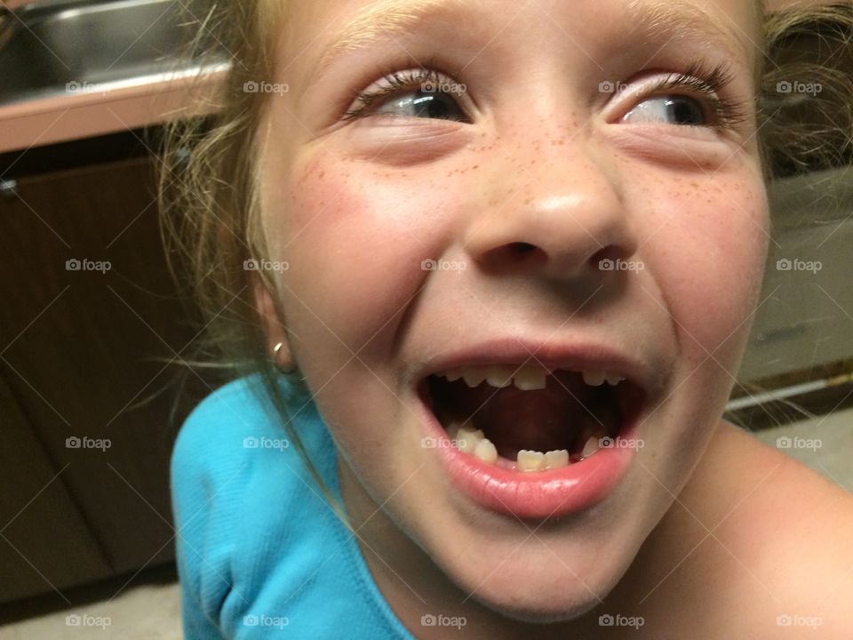 Keeping the Tooth Fairy Busy