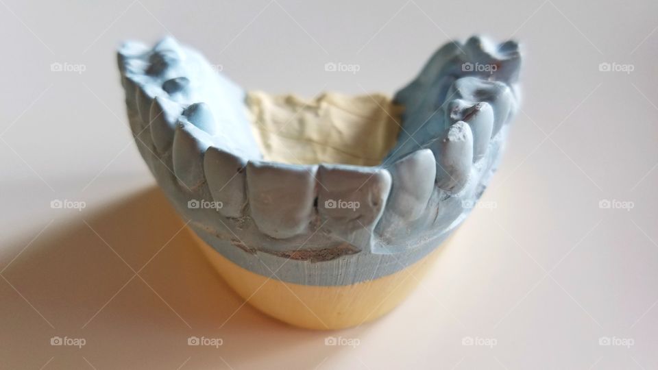 Dental impressions