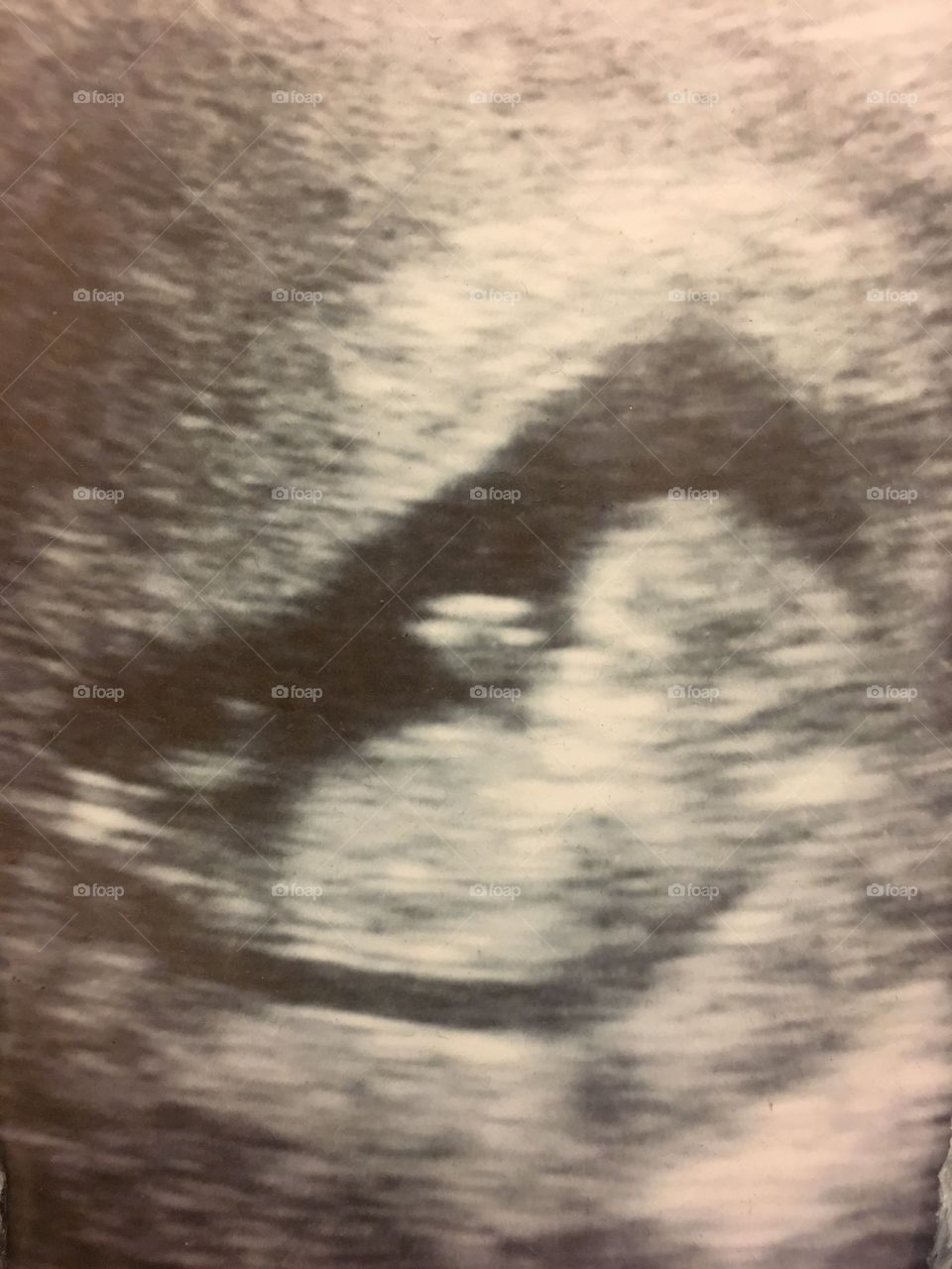 Saying hi from inside the womb.  Hi Enzo 