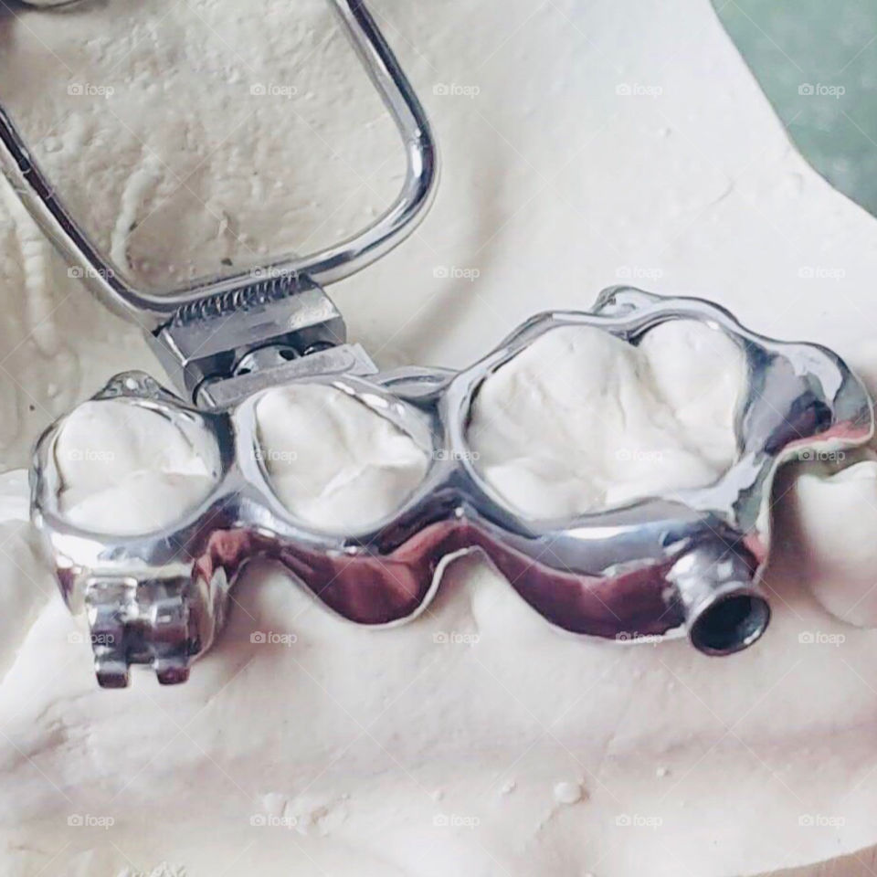 Metal Dental Prosthesis 