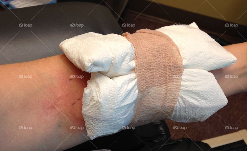 Ice packs after allergy testing
