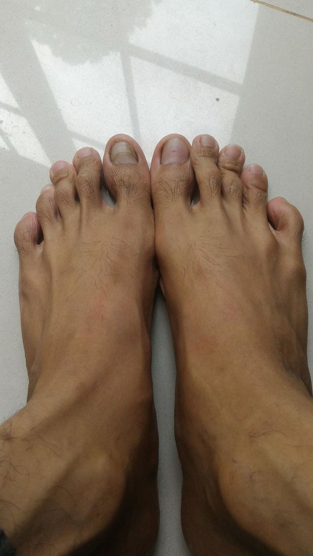 ten ankles