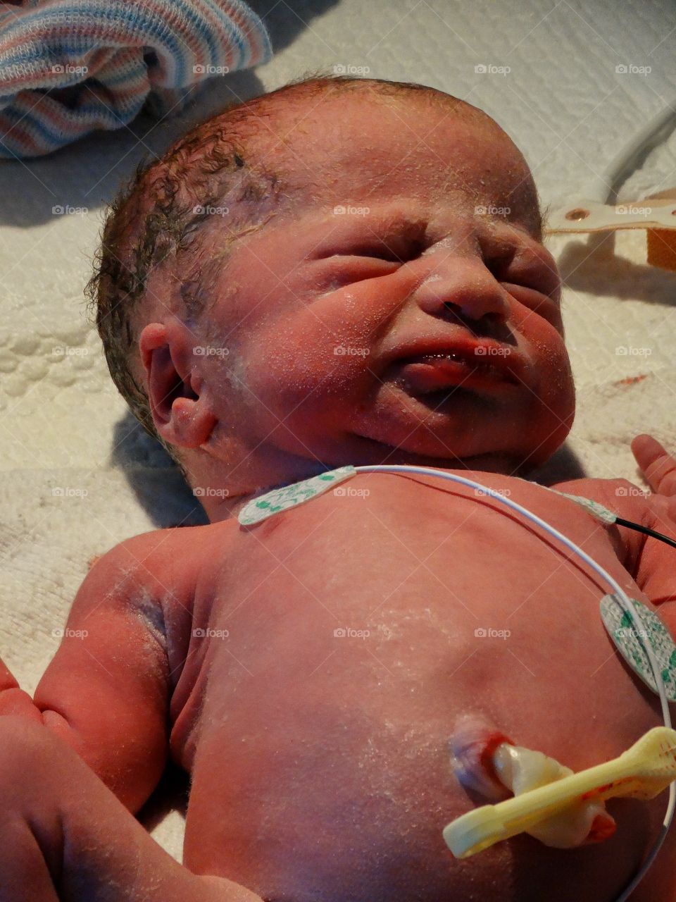 Newborn Infant In Intensive Care
