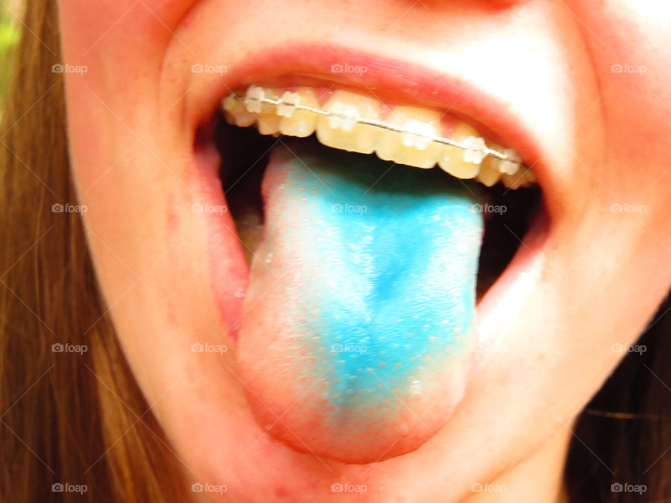 teenage surf's tongue