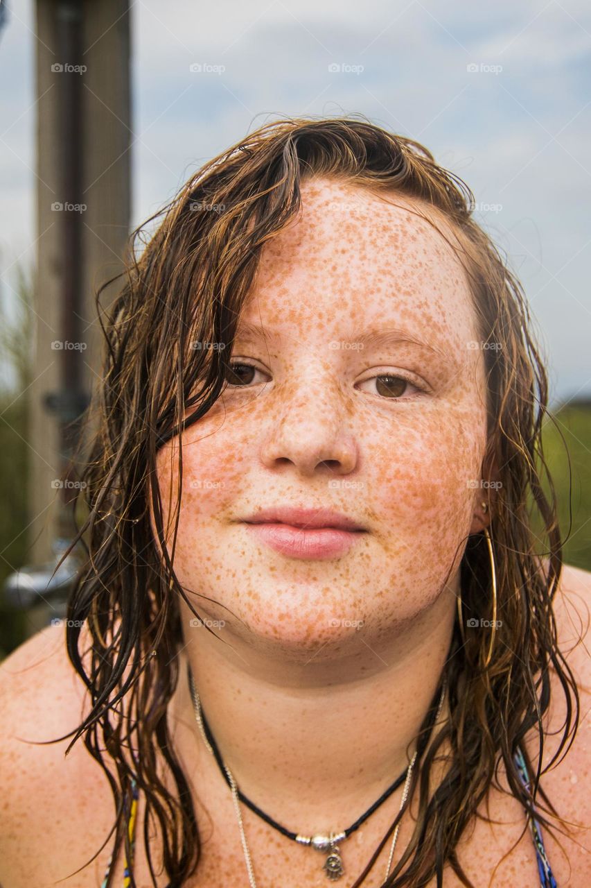 Portrait of freckles 