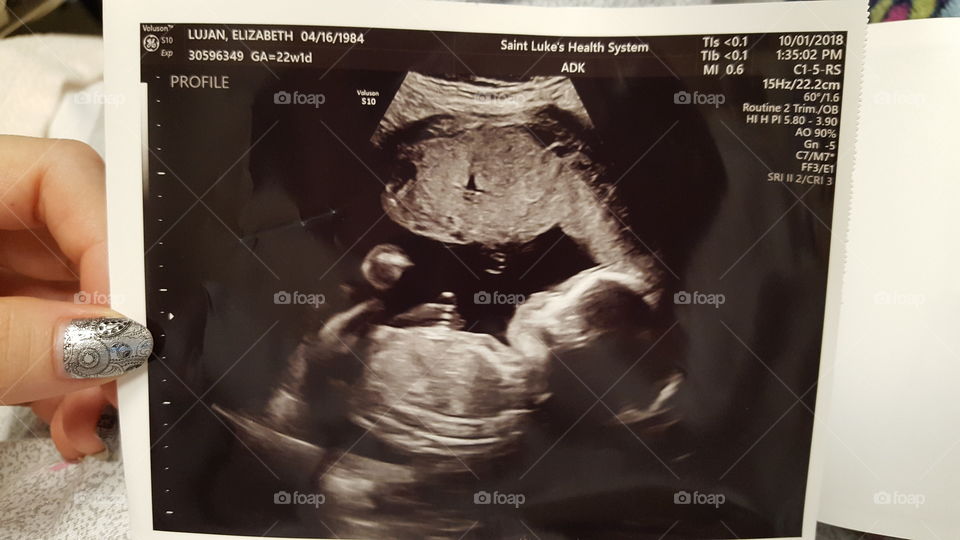 This is another picture of my ultrasound but this time it's a side profile of my baby boy. Isn't he beautiful?