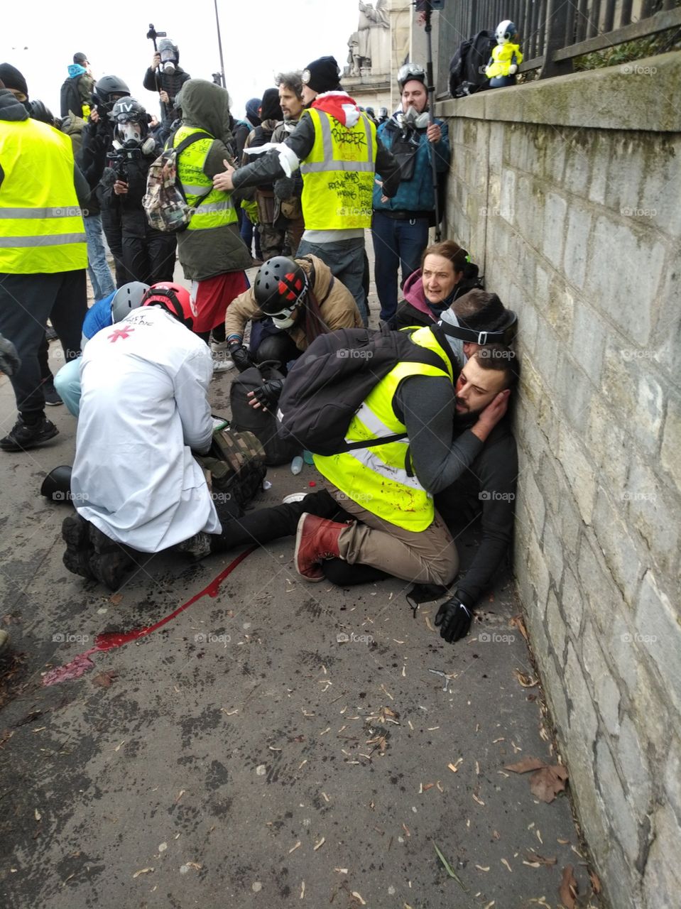 atacan a jóven en Francia con una granada