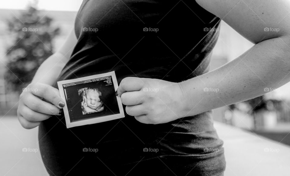 Maternity pose with ultrasound 