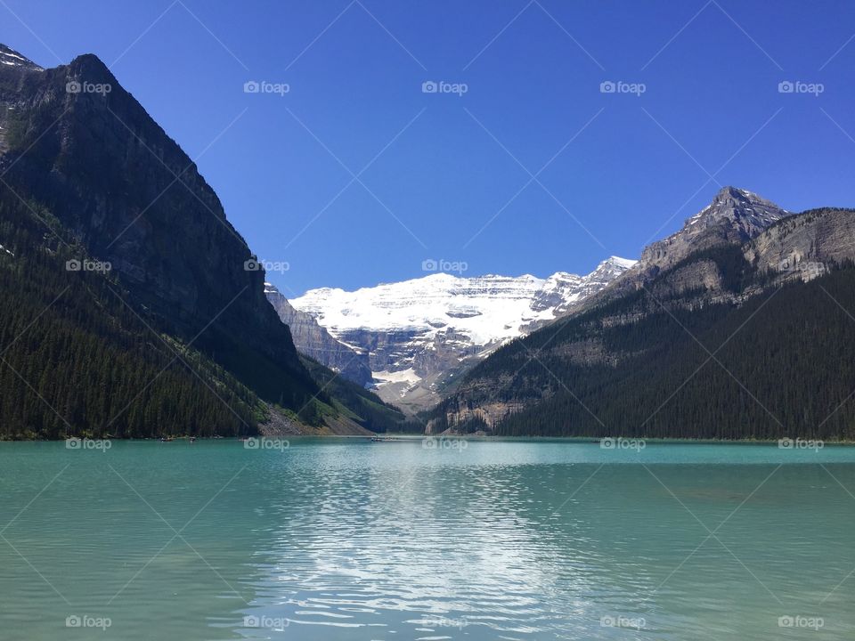 Lake Louise, Alberta, Canada - Travel photography in Summer with snowy mountains, turquoise water and blue sky
