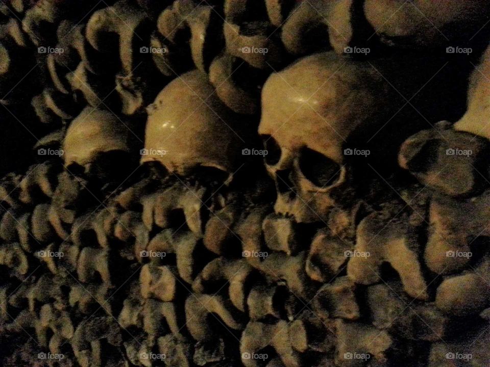Real, Creepy Human Skulls