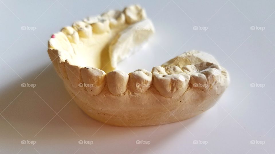 Dental impressions