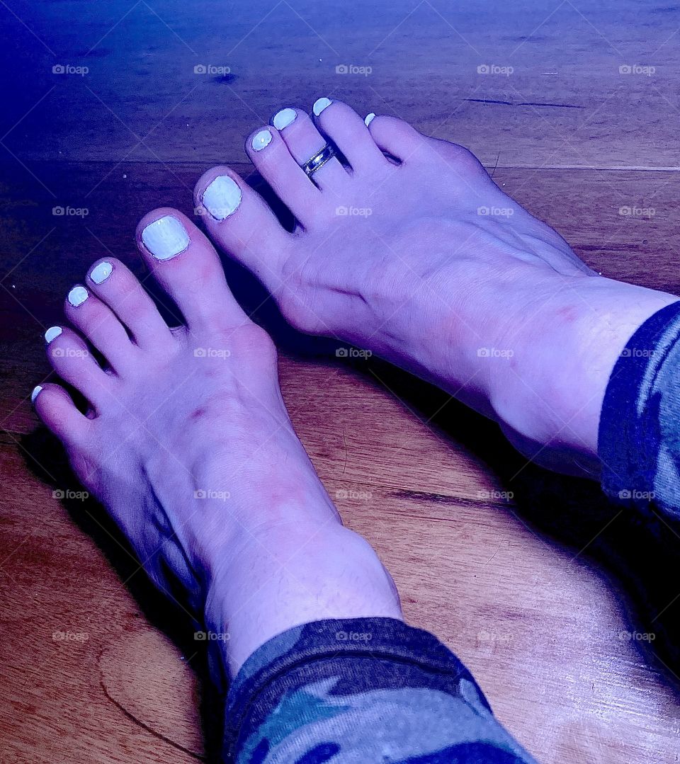 Veiny Dancer Feet resting on hardwood floor with red sore bunions, a white pedicure and a toe ring.