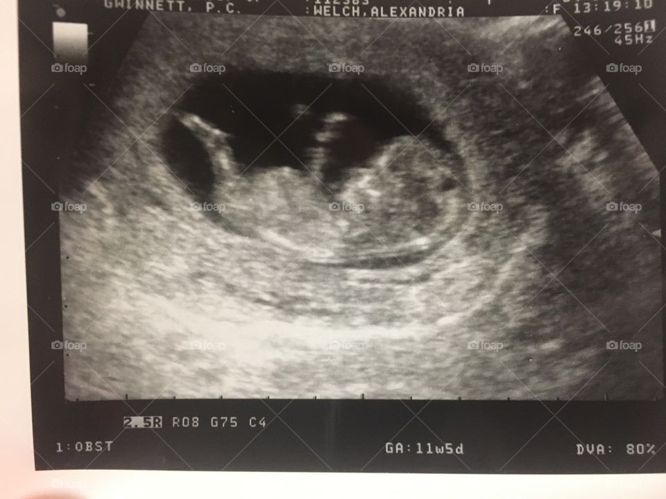 Female ultrasound