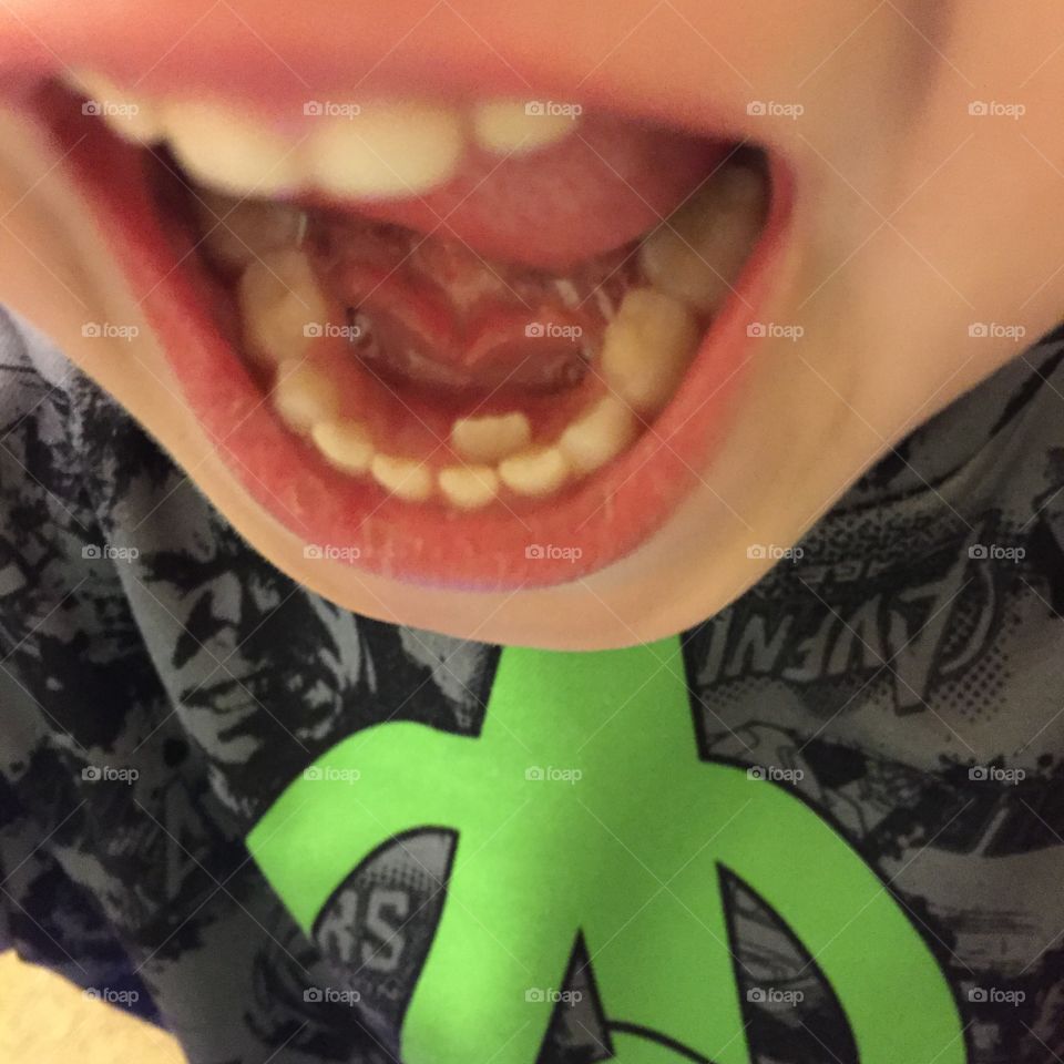 So many teeth. 