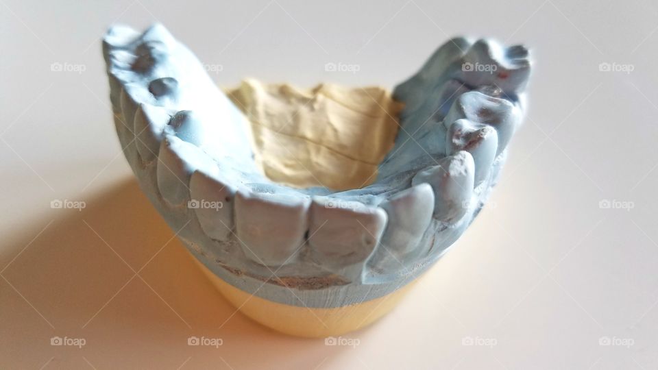 Dental impressions