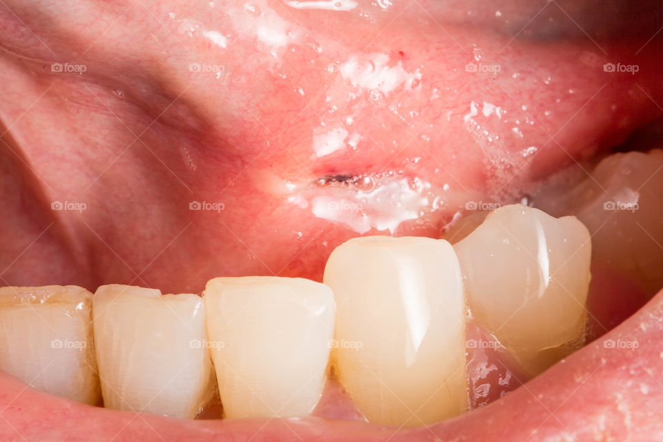 Teeth, Mouth, Dentistry, Tooth, Dental
