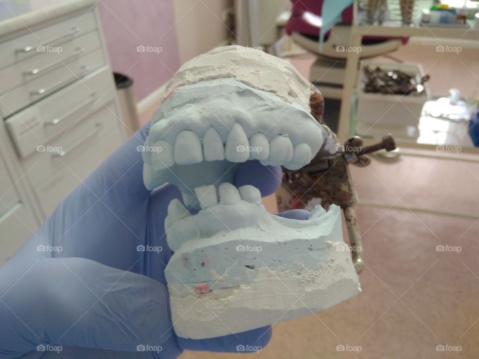 Dental model