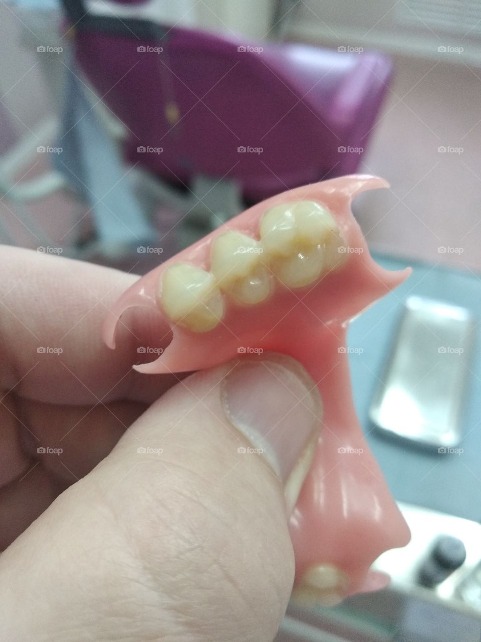 Modern nylon dental denture