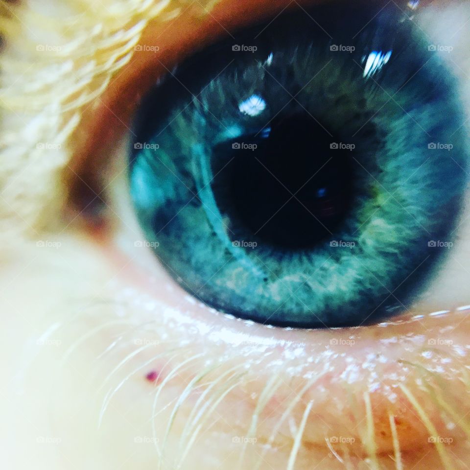Eye