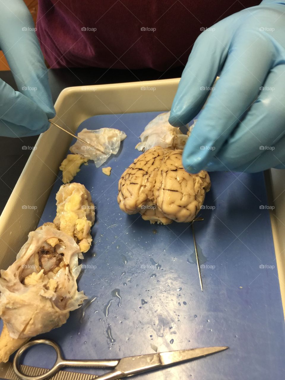Brain inspection