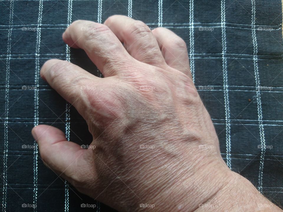 ageing wrinkled hand