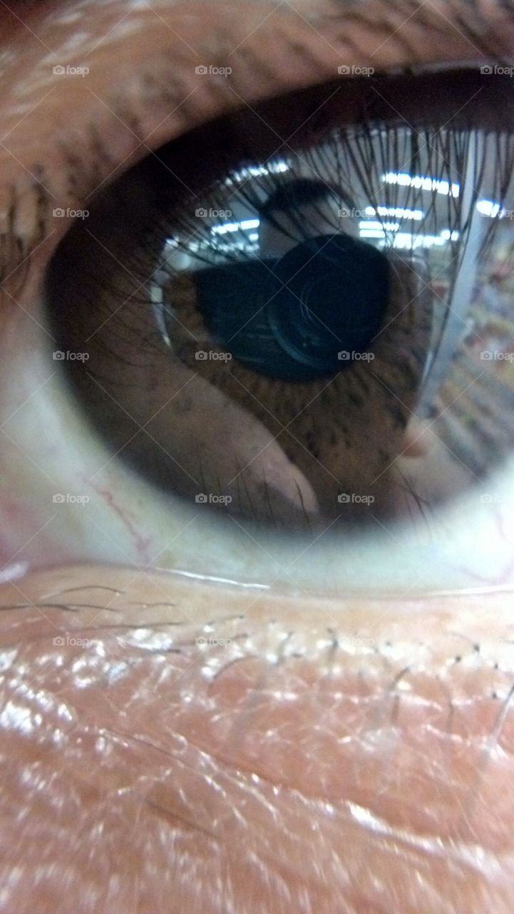 Mi ojo