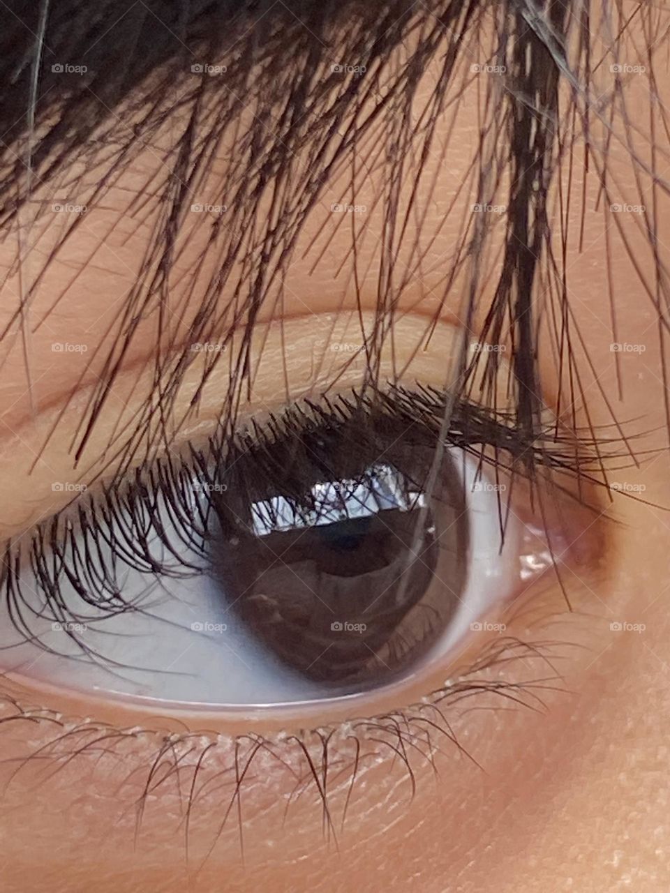 Eye