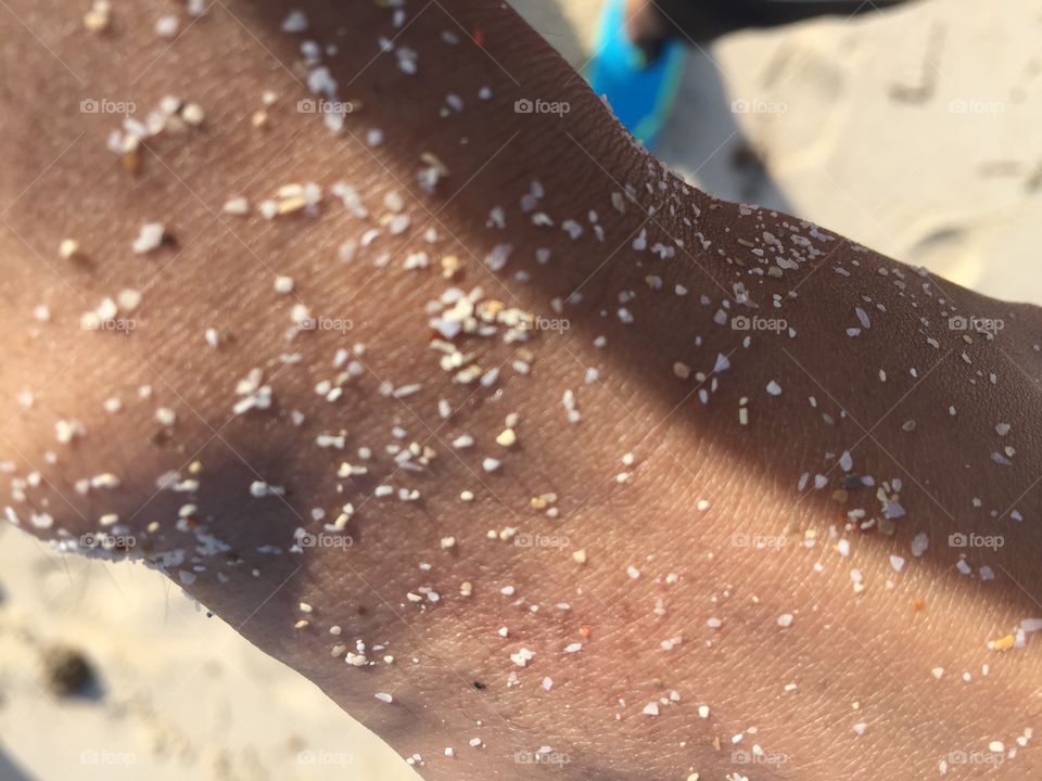 Sand on the person’s arm