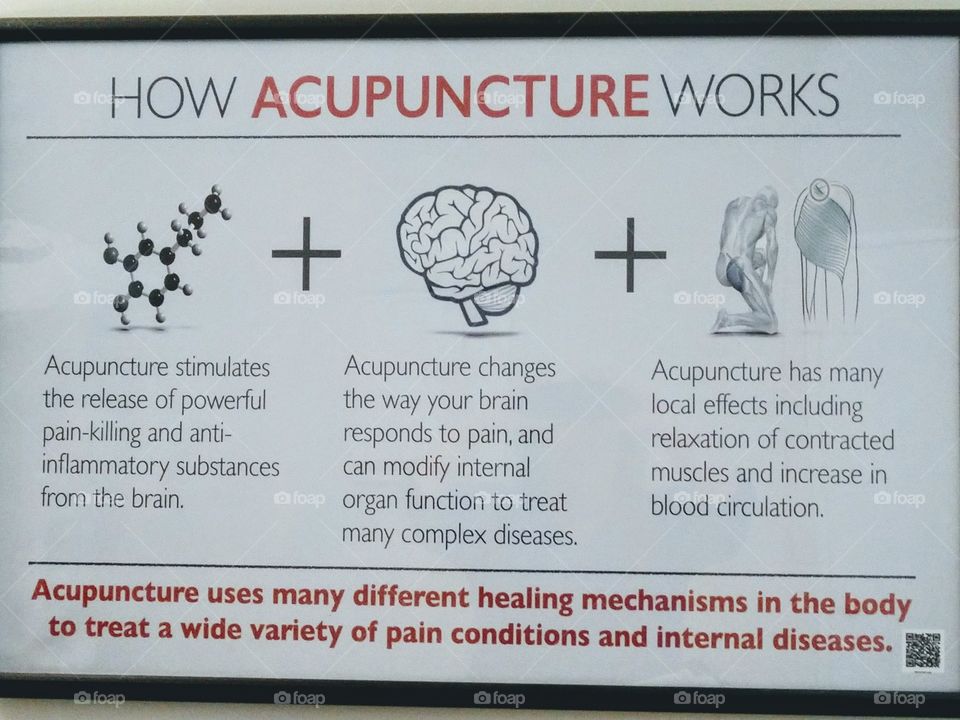 acupuncture sign
