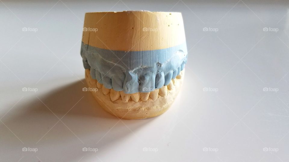 Dental impressions