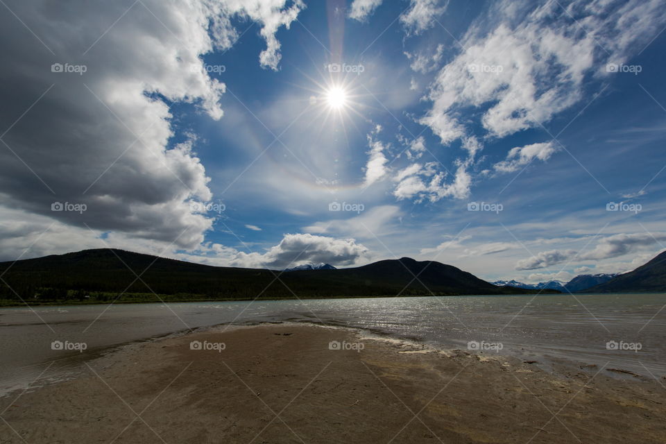 Mountain Sunburst Canada