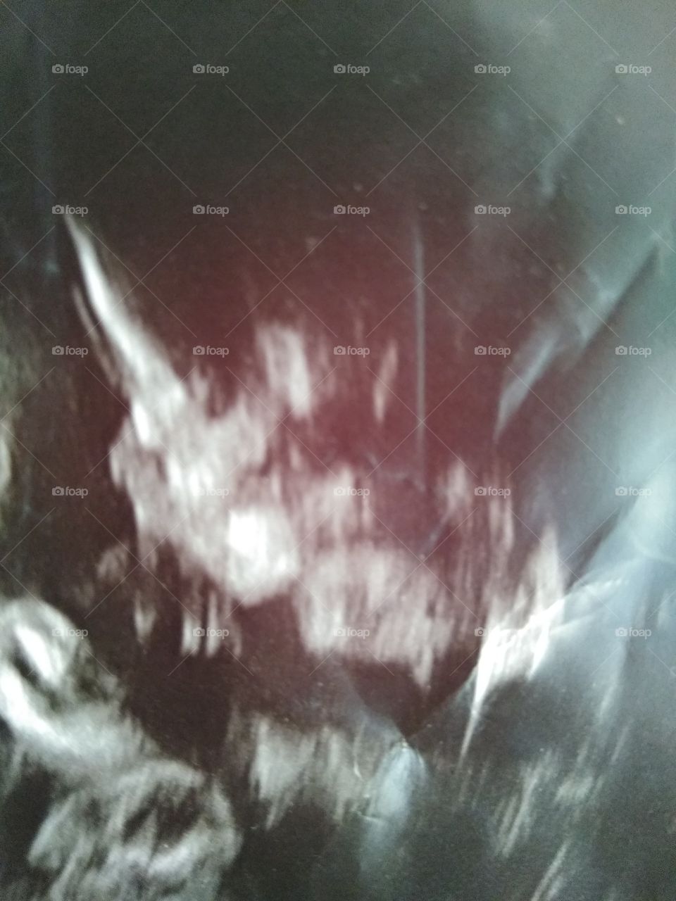baby girl ultrasound
